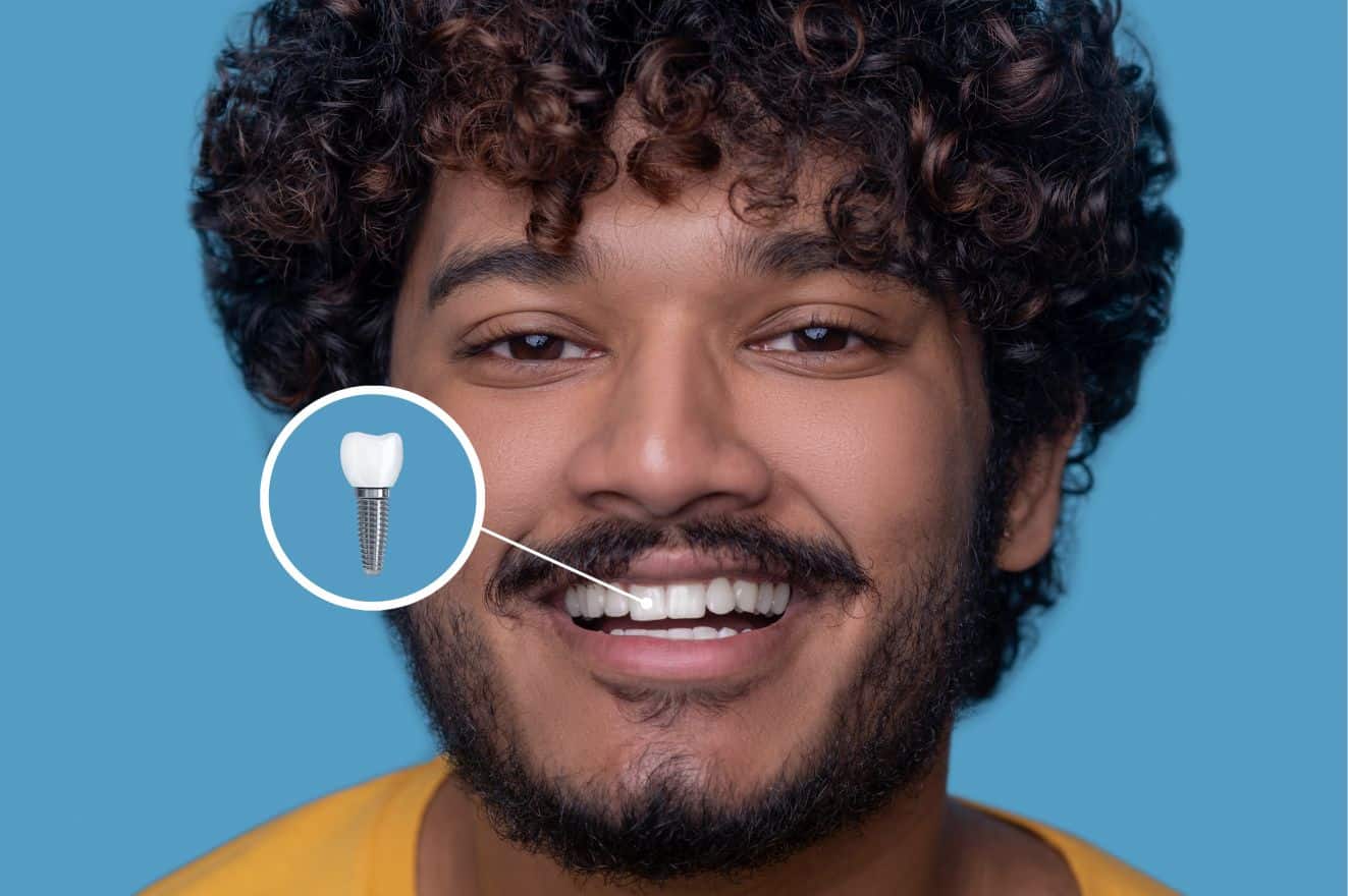 Qual é a melhor idade para realizar um implante dentário